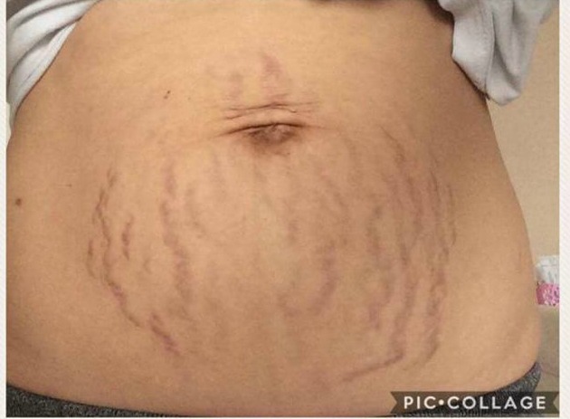 Dora